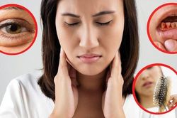 Thiếu vitamin có nguy hiểm?