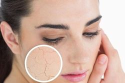 Da có mảng sần sùi, bệnh gì?