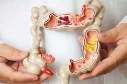 Hàng triệu người Việt vệ sinh sai cách sau khi đại tiện, làm tăng nguy cơ mắc bệnh tật
