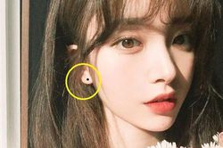 Có nốt ruồi ở 5 chỗ này là 'hố vàng hút lộc', tài lộc suốt đời, tử vi lúc nào cũng đỏ chót