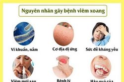 Viêm mũi xoang dị ứng gia tăng do môi trường