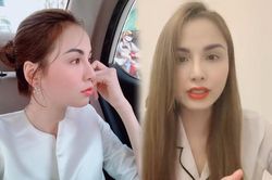 Hoa hậu Diễm Hương lộ sống mũi lệch trước những nghi vấn 'đụng dao kéo'