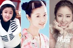 Loạt sao Hoa ngữ 'đổi đời' chỉ nhờ chỉnh răng