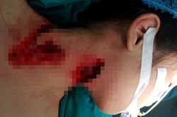 Nhiều trẻ nhập viện do tai nạn sinh hoạt