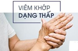 Tăng nguy cơ tử vong do bệnh tim ở bệnh nhân viêm khớp dạng thấp có nồng độ folate thấp