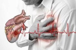 Một số dấu hiệu cảnh báo ngừng tim bạn cần biết