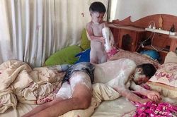 Phát cáu trò nghịch của trẻ em, lơ là một phút 'toang' ngay cả nhà