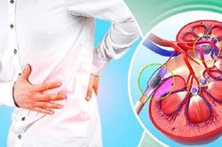 Phương pháp điều trị sỏi thận