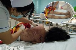 Bắt khẩn cấp chủ quán cà phê đánh đập nhân viên dã man