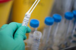 Tình báo Israel 'gom' gấp 100.000 bộ test COVID gửi về nước