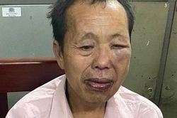 'Trùm' ma túy dùng súng và dao nhọn tấn công Cảnh sát