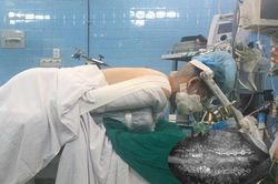 'Chỉnh' lại đầu người phụ nữ mắc bệnh hiếm gặp
