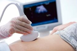 Những điều cần biết về siêu âm ổ bụng