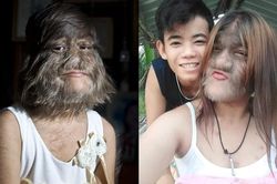Cuộc sống của 'Cô gái người sói' từng nổi tiếng 10 năm trước
