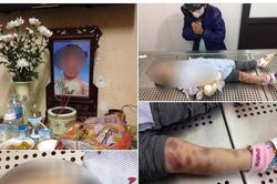 Bắt khẩn cấp cha dượng và mẹ bé gái tử vong nghi bị tra tấn ở Hà Nội