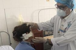 Tái tạo vành tai cho một phụ nữ bị tại nạn sinh hoạt