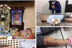 Lời khai ban đầu của cặp bố dượng, mẹ đẻ bạo hành bé 3 tuổi tử vong