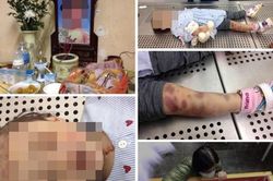 Vụ bé gái 3 tuổi tử vong: 'Tôi đã chứng kiến một vụ mất nhân tính với thiên thần...'