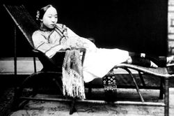 Rùng rợn trào lưu làm gãy xương để có bàn chân 'gót sen 3 tấc'