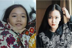 Hotgirl 10X tiết lộ bí quyết trị mụn và cái kết 'dậy thì thành công' khiến dân mạng trầm trồ