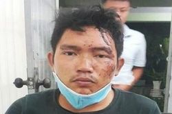 Gã trai dùng dao khống chế đồng nghiệp để cướp 600 triệu