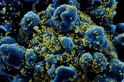 Tìm ra điểm yếu của virus corona