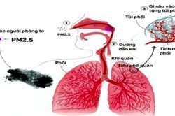 Hệ thống làm sạch không khí
