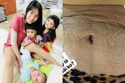 'Mẹ 3 con' Hải Băng chia sẻ hình ảnh cận cảnh vòng 2 đầy vết rạn da chằng chịt, nhiều bà mẹ đều thấy đồng cảm