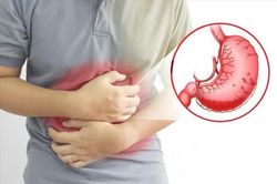 Viêm hang vị sung huyết, điều trị thế nào?