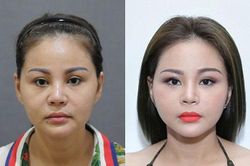 Gương mặt Lê Giang biến đổi sau 20 lần 'dao kéo'