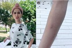 Ngọc Trinh để lộ đôi chân đầy sẹo, than đau… vòng 3 vì diễn tập