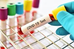 Nhân viên Cty Trường Sinh vừa xuất viện dương tính trở lại với SARS-CoV-2