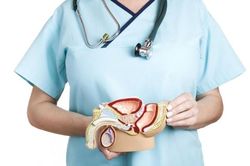 Dấu hiệu nghi ngờ ung thư tuyến tiền liệt
