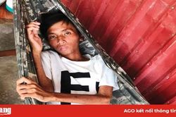 Thanh niên bị bệnh lao và viêm da cần được giúp đỡ