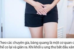 Chỉ cần dựa vào 3 dấu hiệu 'siêu nhỏ' này khi đi tiểu, chị em hoàn toàn có thể phát hiện sớm căn bệnh ung thư bàng quang nguy hiểm