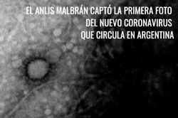 Argentina chụp được hình ảnh virus SARS-CoV-2 lây nhiễm trong nước
