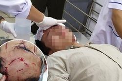 Xông vào trụ sở đánh trọng thương kiểm lâm