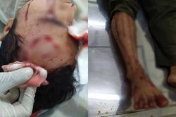 Đang ở trụ sở, kiểm lâm viên bị 10 tên côn đồ xông vào đánh trọng thương