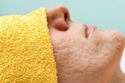 Những nguyên nhân không ngờ khiến bạn sở hữu lỗ chân lông to