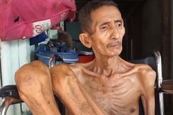 Tìm thấy người đàn ông da bọc xương gây xúc động cộng đồng mạng