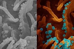 Hình ảnh virus SARS-CoV-2 giải phóng từ một tế bào sắp chết