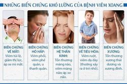 Giải pháp cho người viêm xoang hiệu quả, không tái phát