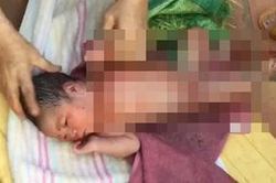 Cứu bé sơ sinh còn nguyên dây rốn, kiến bu cắn bị bỏ rơi ngoài nghĩa địa