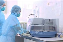 Bệnh nhân ở Hà Nam tử vong do xơ gan không phải do COVID-19, Việt Nam chưa có bệnh nhân COVID-19 nào tử vong