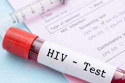 Thực hiện xét nghiệm HIV đúng quy định