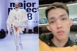 Viêm tụy cấp nguy hiểm thế nào... Hoàng Ân Next Top Model qua đời?
