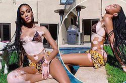 Winnie Harlow diện bikini thả dáng quyến rũ bên bể bơi