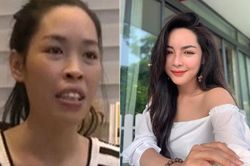 Cuộc đời như bước sang trang mới của 'hotgirl thẩm mỹ' Vũ Thanh Quỳnh sau 5 năm 'lột xác'