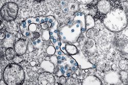 Tìm thấy virus trong tinh dịch người bệnh Covid-19
