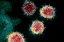Nghiên cứu mới: Không chỉ phổi, virus SARS-CoV-2 còn có thể làm tổn thương não